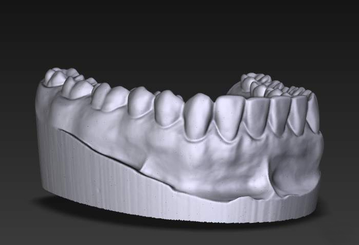 3д моделирование зубов
